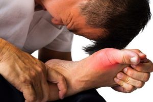 Mục tiêu trong điều trị bệnh gout chính là giúp bệnh nhân giảm bớt đau đớn