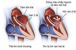 Thuốc chữa bệnh hiệu quả từ cây râm bụt