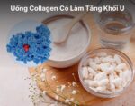 Uống Collagen Có Làm Tăng Khối U