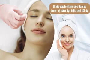 Bí kíp cách chăm sóc da sau laser trị nám đạt hiệu quả tối đa